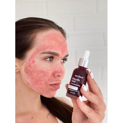 HOLLYSKIN Кислотна сироватка-пілінг для обличчя Glycolic Acid 30 мл